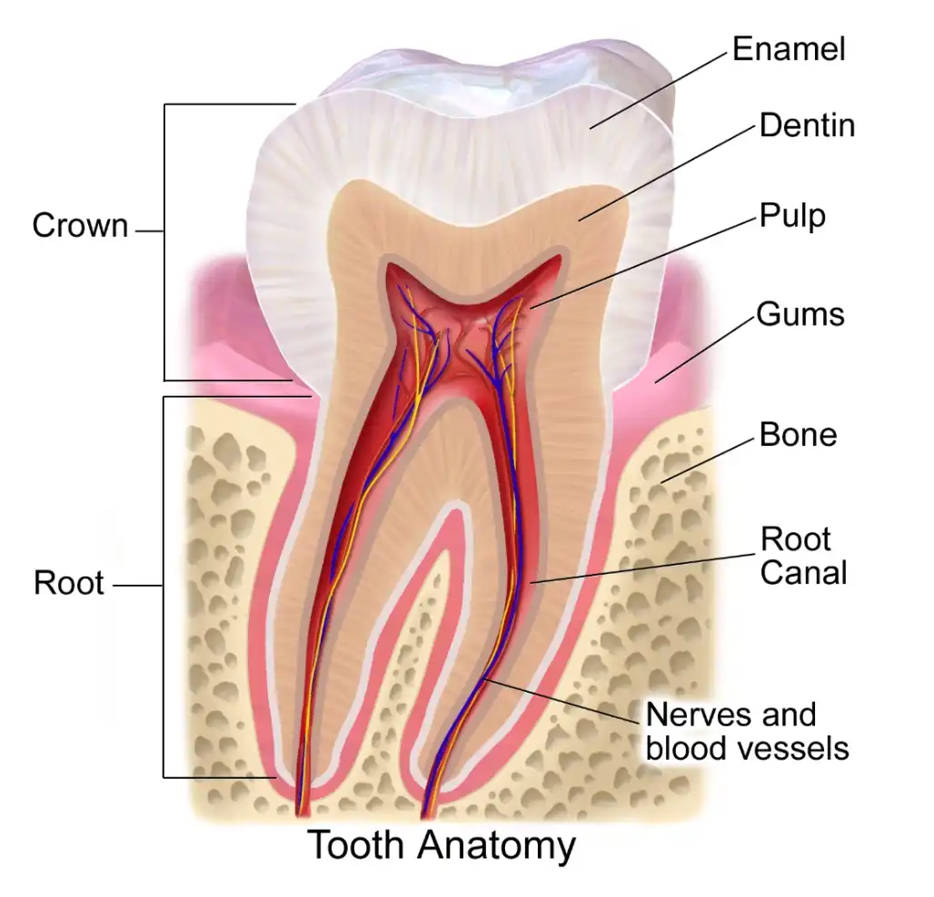 cara mengobati gigi berlubang